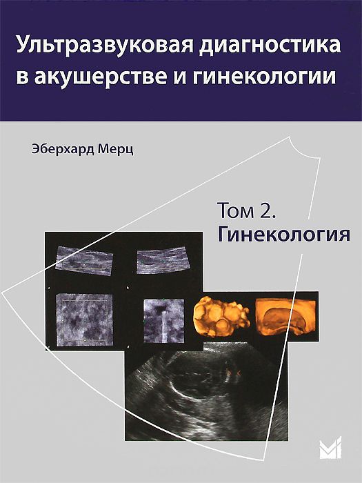 Скачать книгу "Ультразвуковая диагностика в акушерстве и гинекологии. В 2 томах. Том 2. Гинекология, Эберхард Мерц"