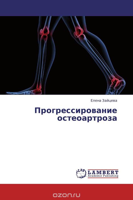 Прогрессирование остеоартроза, Елена Зайцева