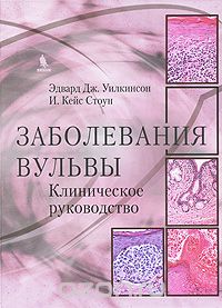 Заболевания вульвы. Клиническое руководство, Эдвард Дж. Уилкинсон, И. Кейс Стоун