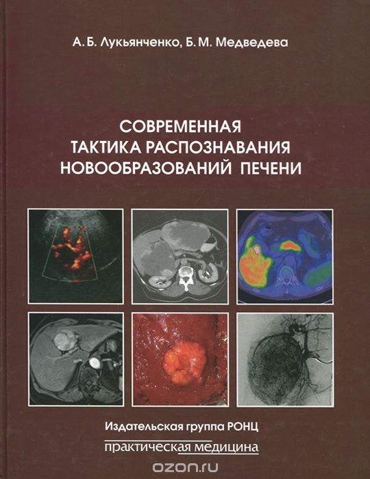 Скачать книгу "Современная тактика распознавания новообразований печени, А. Б. Лукьянченко, Б. М. Медведева"