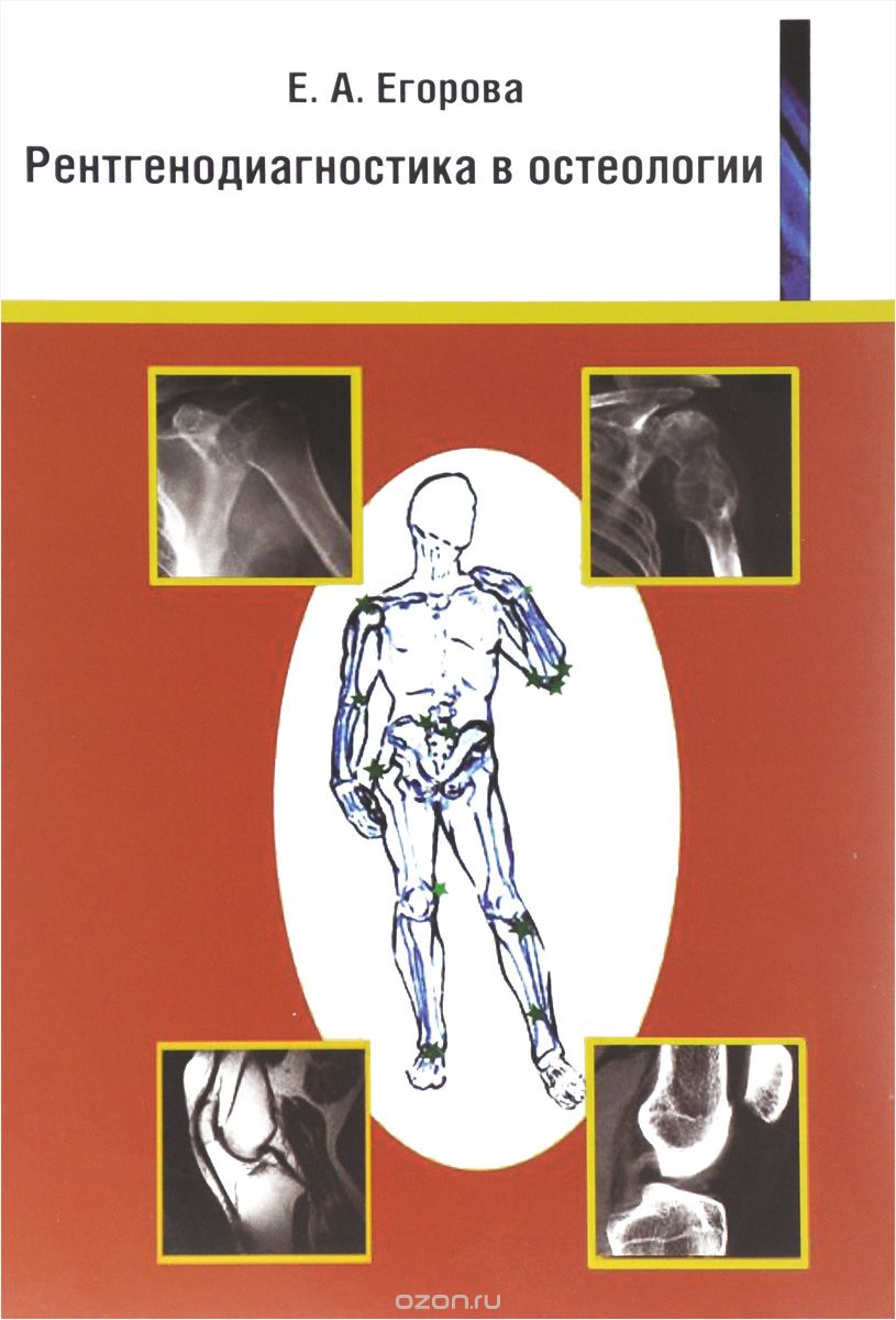 Скачать книгу "Рентгенодиагностика в остеологии. Учебное пособие, Е. А. Егорова"