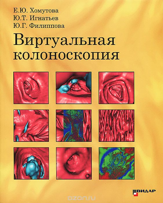 Скачать книгу "Виртуальная колоноскопия, Е. Ю. Хомутова, Ю. Т. Игнатьев, Ю. Г. Филиппова"