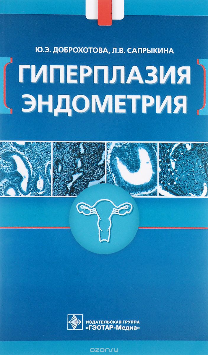 Скачать книгу "Гиперплазия эндометрия, Ю. Э. Доброхотова, Л. В. Сапрыкина"